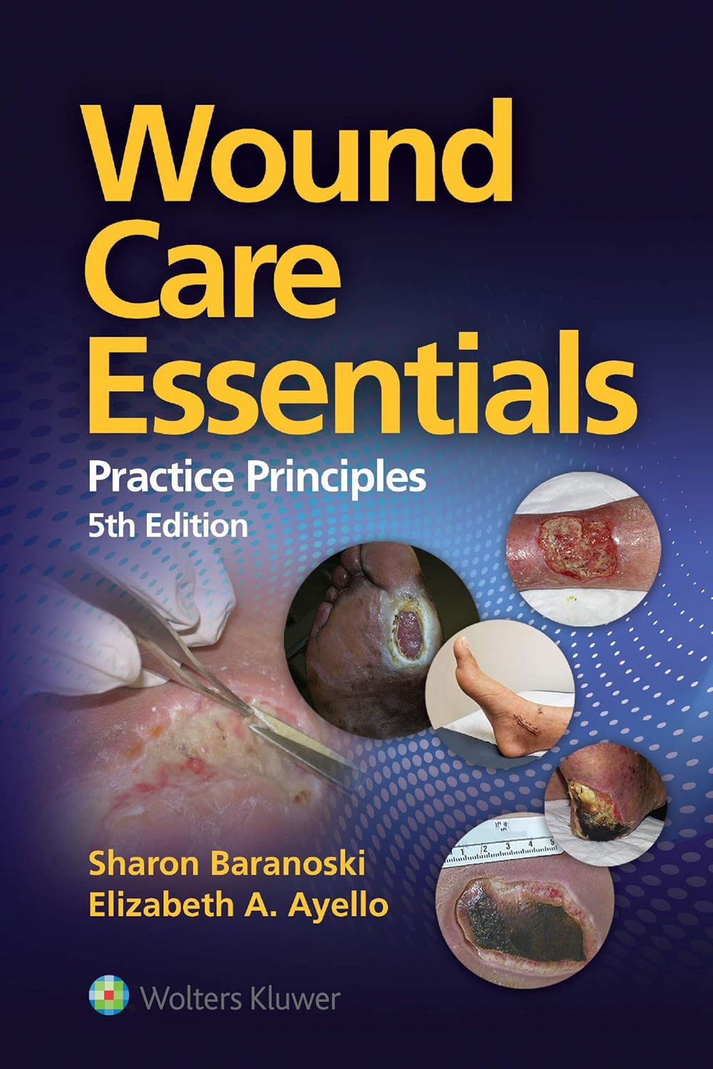 81It6ANks1LSL1500-1.jpg Wound Care Essentials 5th Edition - Image 1