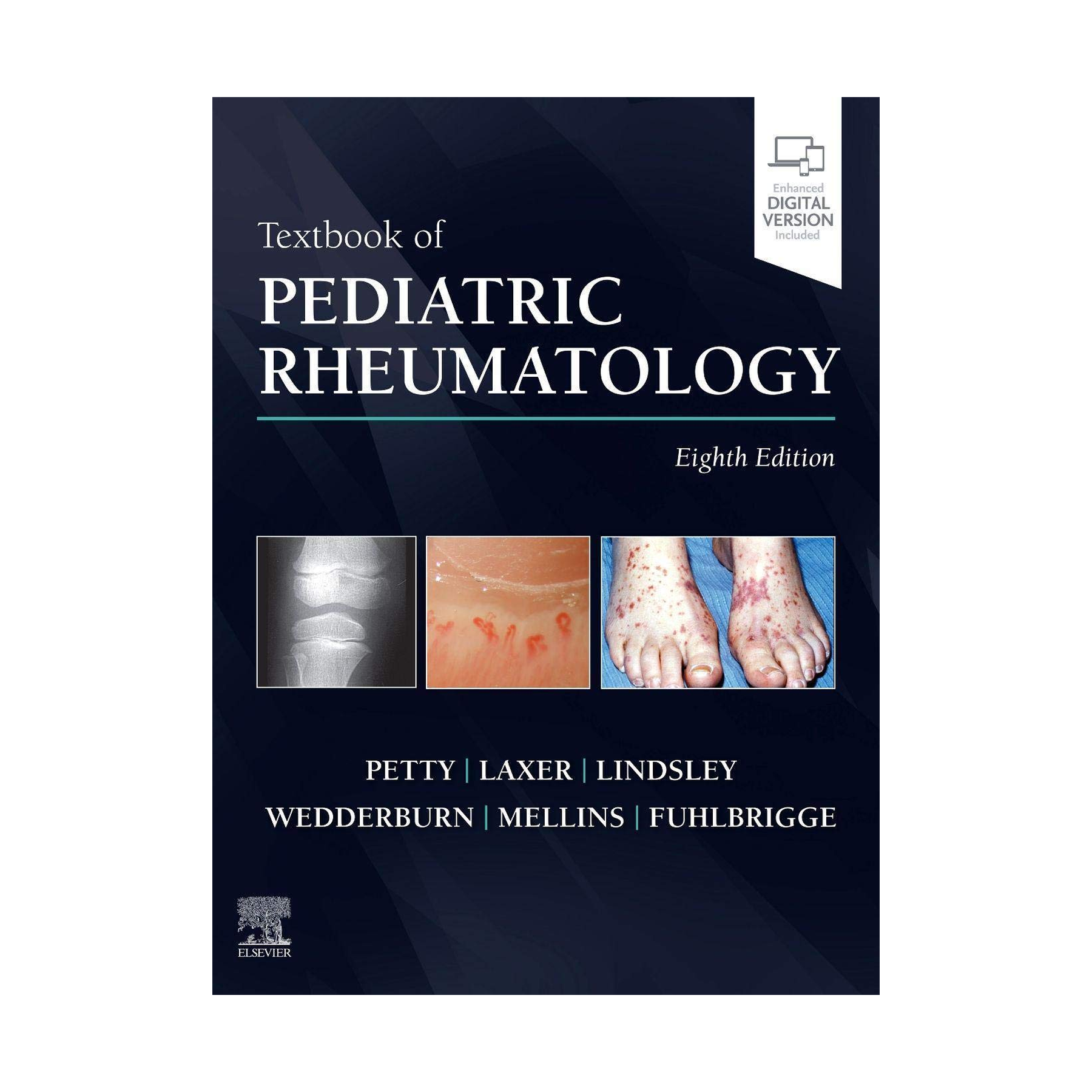 textbook-of-pediatric-rheumatology-8th-edition-1.png Textbook of Pediatric Rheumatology 8th Edition - Image 1
